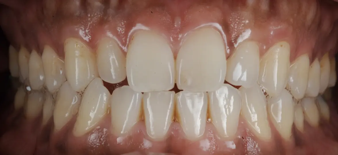 clinical-case-008-1
