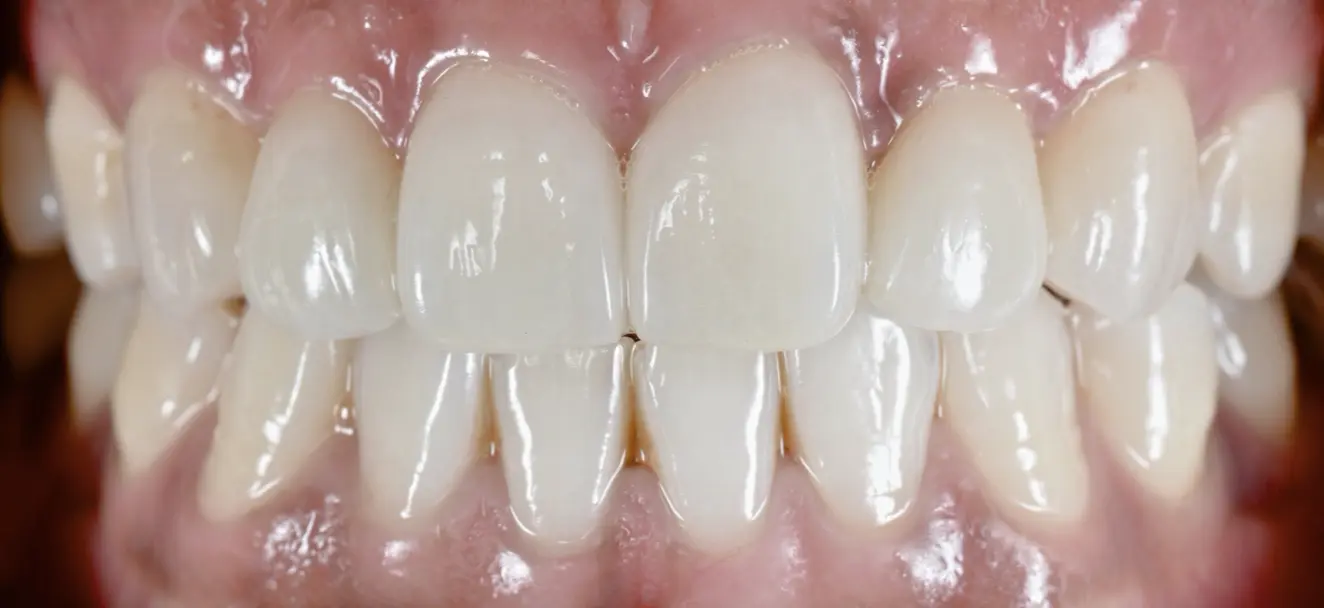 clinical-case-008-2
